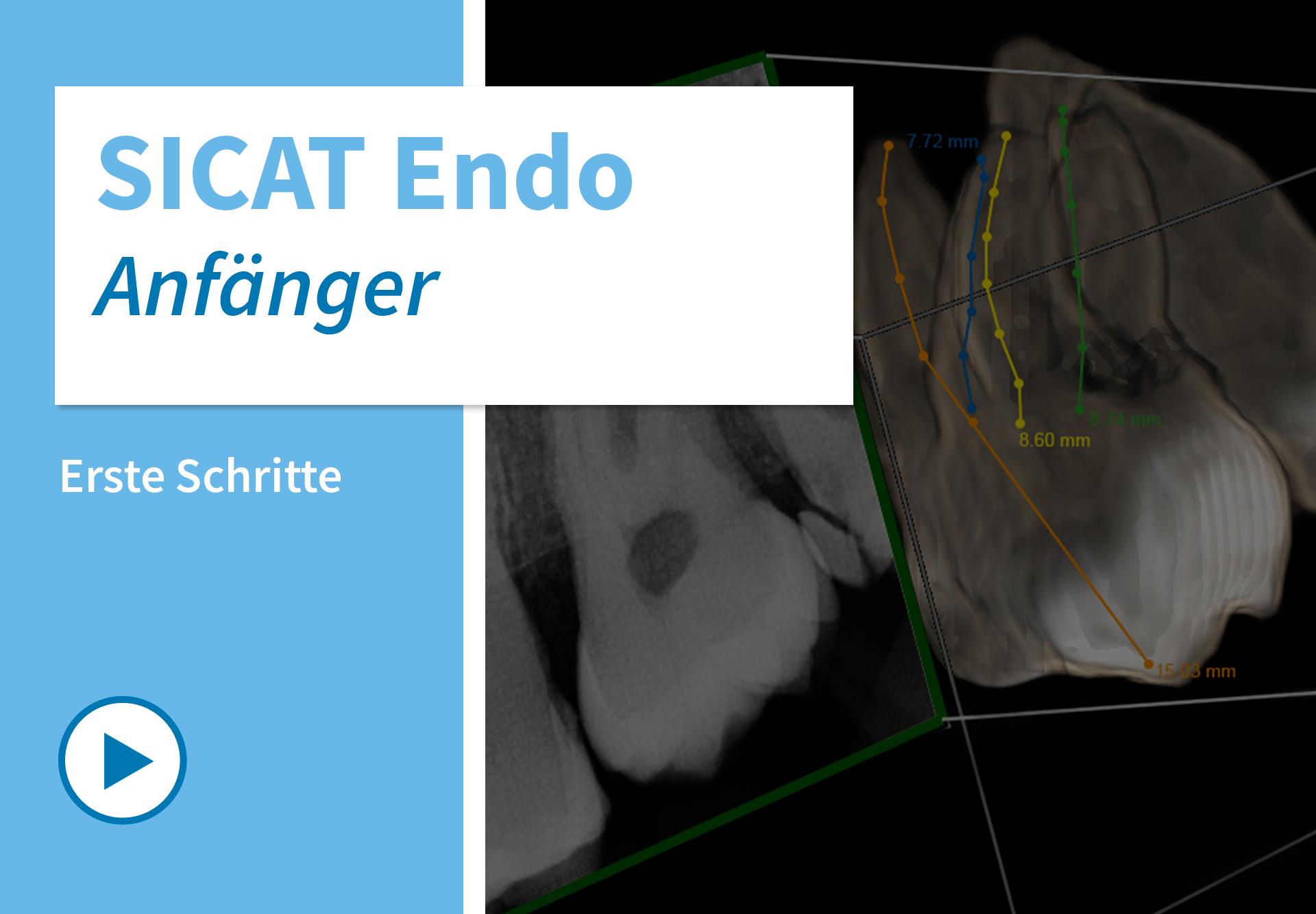 Endo_Startseite_DE
