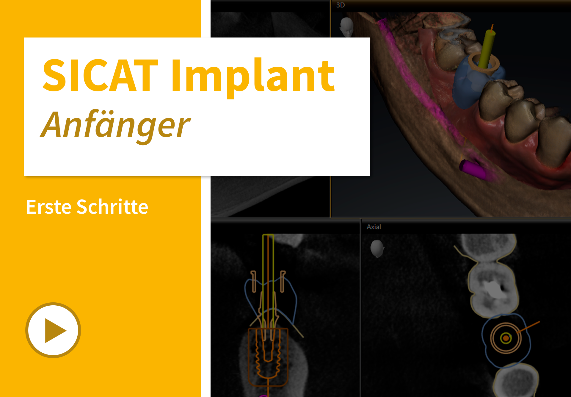 Implant-01_Startseite_DE