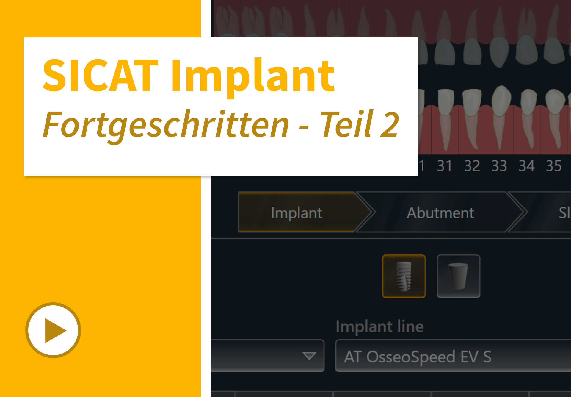 Implant-03_Startseite_DE